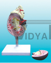 The dissection model of kidney